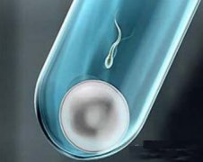要如何提高精子的成活率